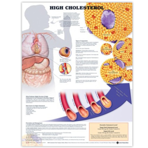 HIGH CHOLESTEROL CHART 51 X 66CM RIGID Each