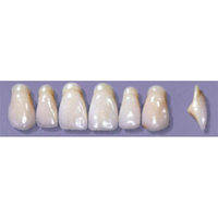 MYERSON ANTERIORS #A13/D (1x6 CARD) Card