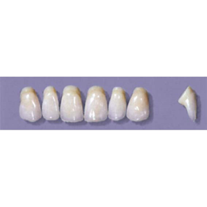 Myerson Anteriors #YM3/58 (1 x 6 Card), Each